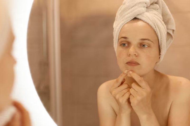 retinol para el acné